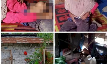 Derita Hernia Sejak Puluhan Tahun, Nenek di Siulak Kerinci Ini Butuh Uluran Tangan