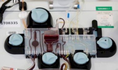 RS Inggris Uji Coba Pengobatan Plasma Darah Pasien COVID-19, Begini Caranya...