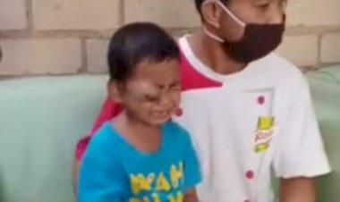 Derita Kanker di Mata, Bocah Berusia 4 Tahun di Sungaipenuh Ini Butuh Perhatian