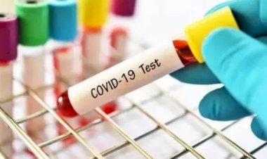 Update! COVID-19 20 Juni 2020: Positif Tembus 45.029 Orang, Bertambah 1.226 Kasus