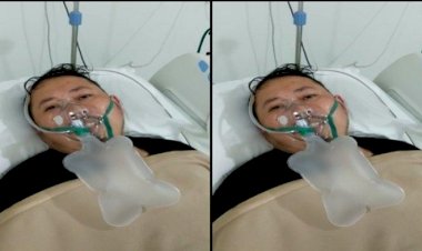 Viral! Jaksa Fedrik Adhar Pakai Ventilator Sebelum Wafat, Begini Fakta Penyakitnya