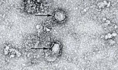 Wow, Potensi Virus Covid-19 di Indonesia Lebih Cepat Menular? Begini Kata LIPI
