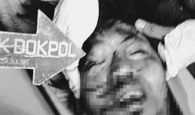 Ini Wajah Terduga Pelaku Bom Bunuh Diri di Makassar, Siapa Dia?