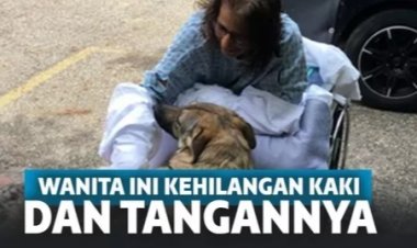 Gegara Dijilati Anjing Peliharaan, Wanita Ini Hilang Tangan dan Kakinya