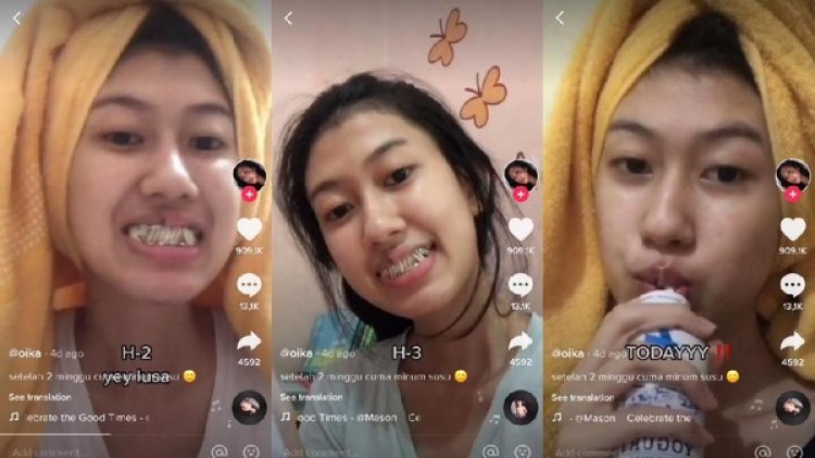 Cewek Cantik Ini Giginya Dikunci 2 Minggu, Begini Nasibnya