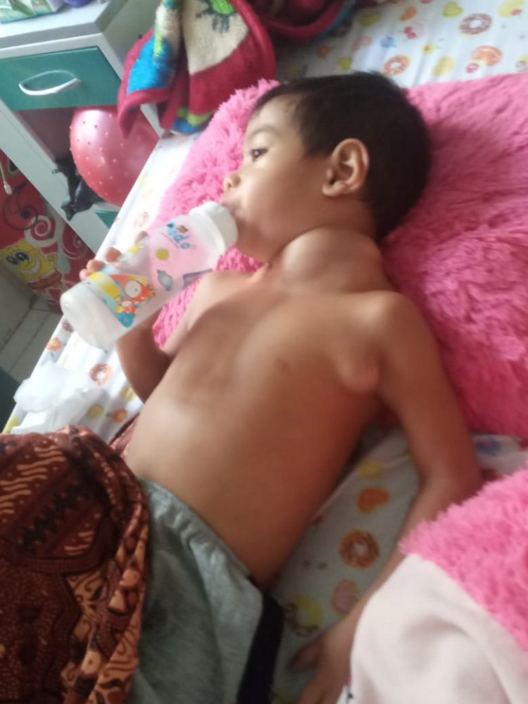 Ayahnya Meninggal 5 Hari Lalu, Balita Malang Ini Dilarikan ke RSUD Akibat Menderita Kelenjar Getah Bening