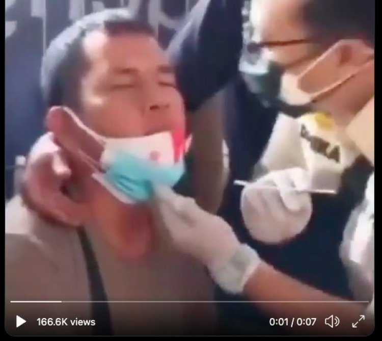 Heboh! Petugas Cium Pria Saat Tes Swab, Dinkes DKI: Pengetesan Seperti Itu Berisiko Menularkan Corona