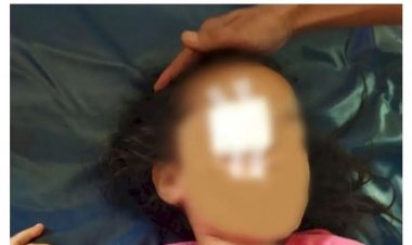 Tega! Ibu dan Ayah Cungkil Mata Anak Perempuan Mereka: Assulukko! Assulukko!