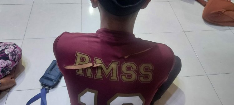 Lagi Genk Motor Beraksi, Pemuda Aur Duri di Jambi jadi Korban Pembacokan