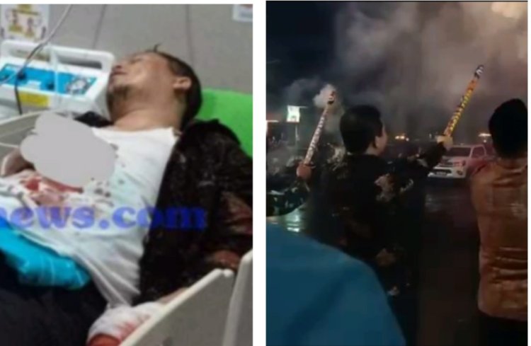 NAHAS! Saat Rayakan Malam Tahun Baru, Petasan Dipegang Wabup Kaur Meledak