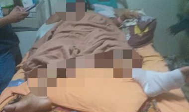 Nyaris Diperkosa, Wanita Cantik Ini Patah Kaki Terjun di Ketinggian 7 Meter