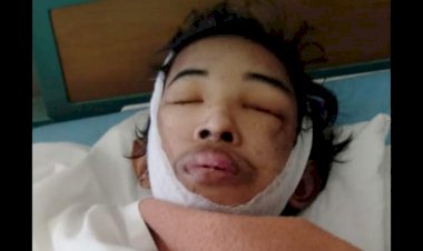 BREAKING NEWS!! Dinyatakan Meninggal, Pengidap Tumor Paru Racjhu Dikabarkan Bernafas Kembali Usai Dimandikan