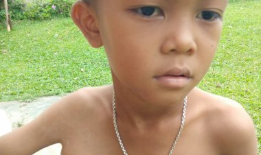 Derita Tumor di Ketiak, Bocah Enam Tahun di Jujuhan Bungo Ini Butuh Uluran Tangan Dermawan