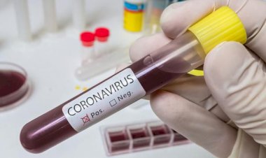 WNI Terkena Virus Corona COVID-19 di Singapura Sembuh