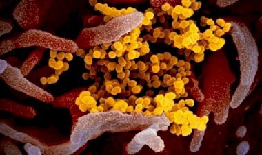 Korban Tewas akibat COVID-19 di Italia Menjadi 10.779