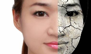 6 Gejala kerusakan di wajah yang menandakan ritual kecantikanmu perlu diubah