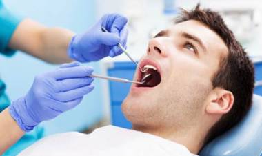 Veneer Gigi, Untuk Kesehatan atau Gaya Hidup?