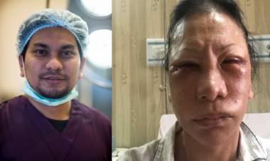 Tompi Sebut Bengkak Wajah Ratna Sarumpaet Bekas Operasi Plastik