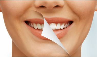 Cara Memutihkan Gigi dengan Kunyit