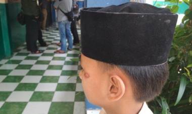 Tak Terima Kepala Anaknya Diadu, Pipit Laporkan Kepsek SMP Garut ke Polisi