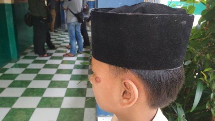 Polisi Selidiki Dugaan Kepala Sekolah Aniaya Siswa di Garut