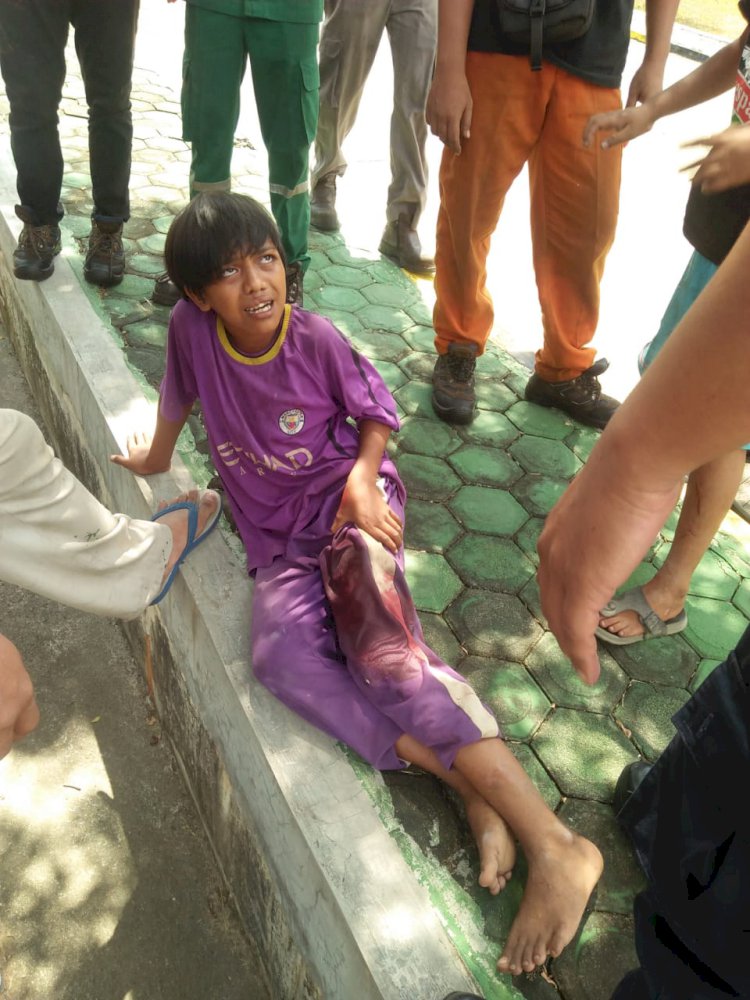 Asyik Mancing, Saripudin Nyaris Tewas Digigit Buaya