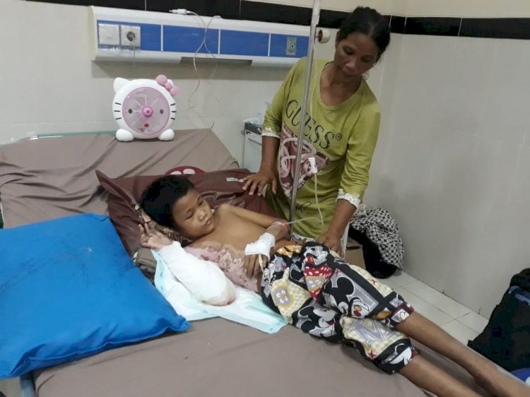 Diduga Dianiaya Ayah Tiri, Bocah Asal Muarojambi Ini Alami Luka Bakar Serius